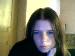 Milia photo # 1