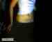 xcandiEkiddx photo # 7