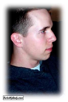 Franckaera51