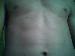 hnx7