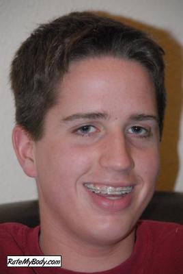 mikron726