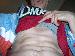 oblique