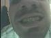 pukch