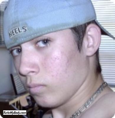 wiggerboy420