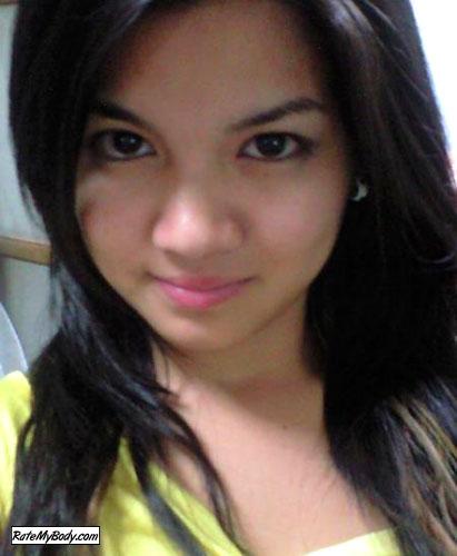 xrachePHx